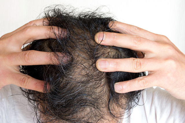 いいねヘアケアラボ（いいね鍼灸院）は効果がない！？