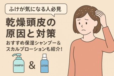 【ふけが気になる人必見】乾燥頭皮の原因と対策｜おすすめ保湿シャンプー＆スカルプローションも紹介！